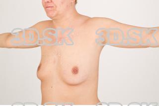 Breast texture of Pat 0001